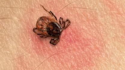 Safe and Smart: How to Properly Dispose of Ticks and Prevent Tick-Borne Diseases