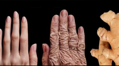 The Best Vitamin to Remove Age Spots Naturally, According to Skin Experts