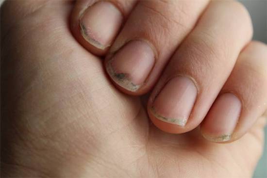 Dirty Nails or Honest Work? What Fingernails Can Really Say About a Person